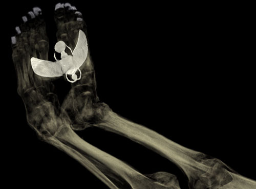 CT scan of the feet of Tayesmutengebtiu, also called Tamut, to show the metal covers on her toenails and the large amulet of the winged scarab beetle Khepri. © Trustees of the British Museum.
